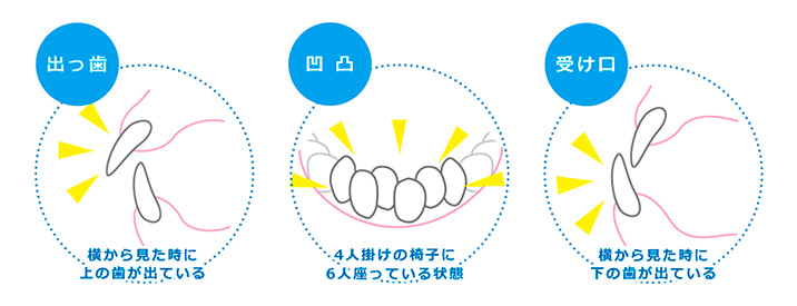 MRC矯正