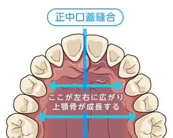 不正咬合の根本的な治療方法「顎顔面矯正」について