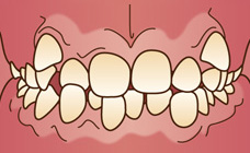 顎顔面矯正